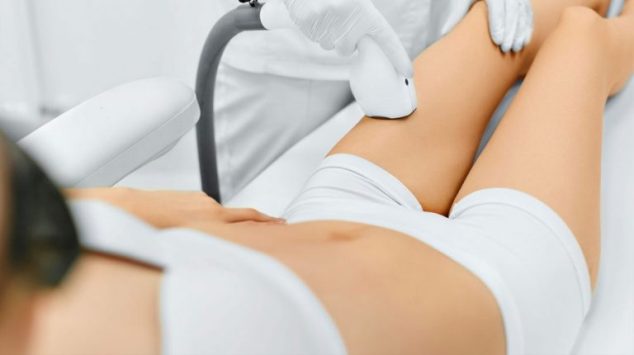 diode laser hair removal